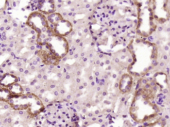 C1orf172 Rabbit Polyclonal Antibody