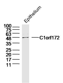 C1orf172 Rabbit Polyclonal Antibody