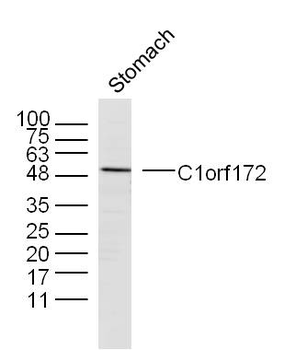 C1orf172 Rabbit Polyclonal Antibody