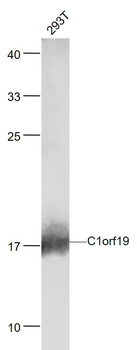 TSEN15/C1orf19 Rabbit Polyclonal Antibody