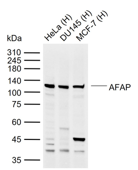 AFAP Rabbit Polyclonal Antibody