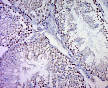 C20orf132 Rabbit Polyclonal Antibody