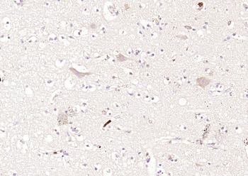 MARCH6 Rabbit Polyclonal Antibody