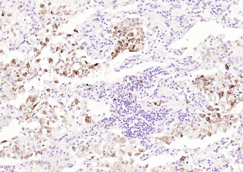 MARCH6 Rabbit Polyclonal Antibody