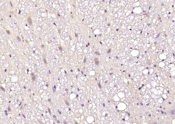 MARCH6 Rabbit Polyclonal Antibody