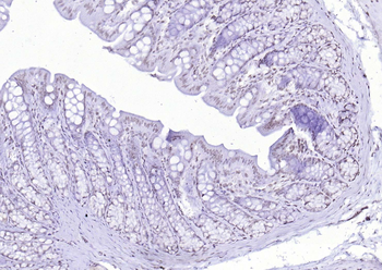 RNF113A Rabbit Polyclonal Antibody