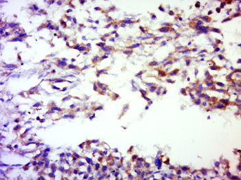 SERPINB12 Rabbit Polyclonal Antibody