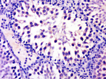 RNF93 Rabbit Polyclonal Antibody