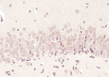 FAM46C Rabbit Polyclonal Antibody