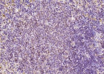 FAM46C Rabbit Polyclonal Antibody