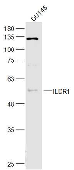 ILDR1 Rabbit Polyclonal Antibody