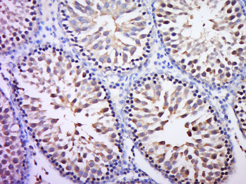 CT112 Rabbit Polyclonal Antibody