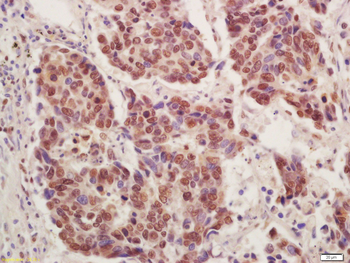CT112 Rabbit Polyclonal Antibody