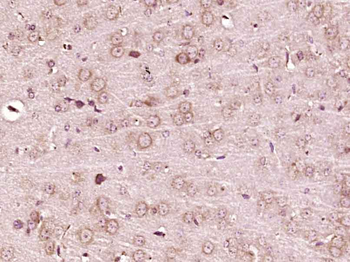 POMC Rabbit Polyclonal Antibody