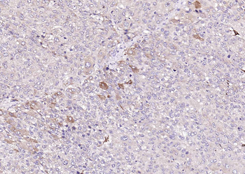 HHLA2 Rabbit Polyclonal Antibody