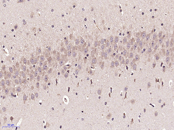 BTNL2 Rabbit Polyclonal Antibody