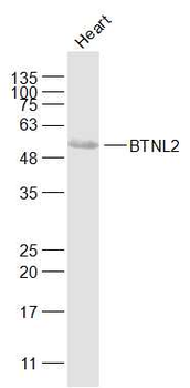 BTNL2 Rabbit Polyclonal Antibody