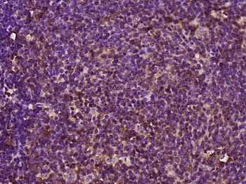 CCDC102B Rabbit Polyclonal Antibody