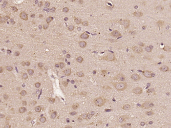 CCDC102B Rabbit Polyclonal Antibody