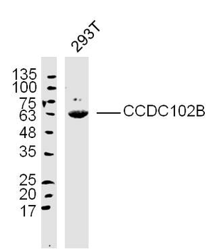 CCDC102B Rabbit Polyclonal Antibody