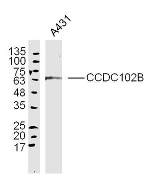 CCDC102B Rabbit Polyclonal Antibody