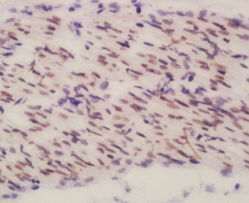 BEND3 Rabbit Polyclonal Antibody