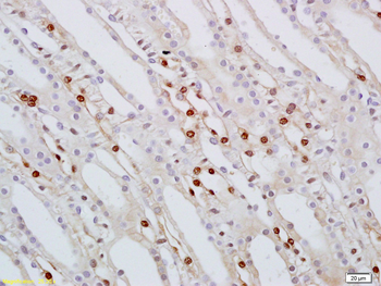 SMARCA2 Rabbit Polyclonal Antibody