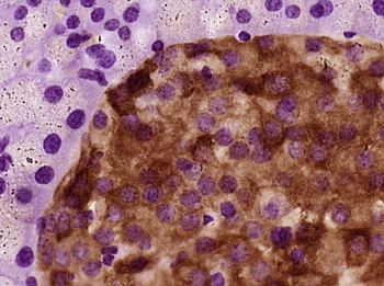 PRLR Rabbit Polyclonal Antibody