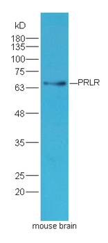 PRLR Rabbit Polyclonal Antibody