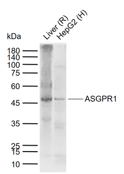 ASGPR1 Rabbit Polyclonal Antibody
