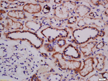 ATG101 Rabbit Polyclonal Antibody