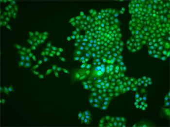 AMPK beta 1/PRKAB1 Rabbit Polyclonal Antibody