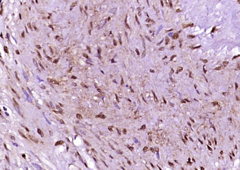 AMPK beta 1/PRKAB1 Rabbit Polyclonal Antibody