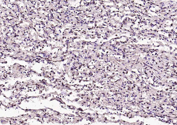 AMPK beta 1/PRKAB1 Rabbit Polyclonal Antibody