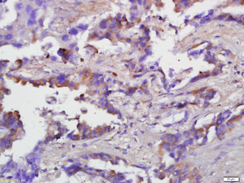 Caspase-1 p20 Rabbit Polyclonal Antibody