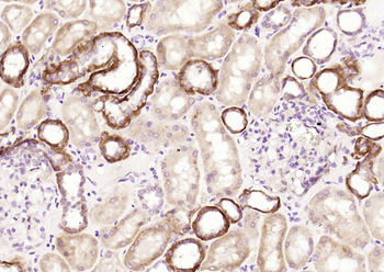 CCBL1 Rabbit Polyclonal Antibody