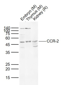 CCR-2 Rabbit Polyclonal Antibody