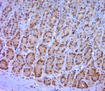 Cryptochrome 1 Rabbit Polyclonal Antibody