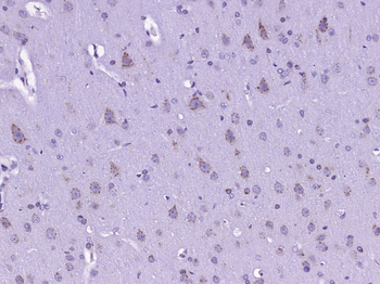 CARD12 Rabbit Polyclonal Antibody