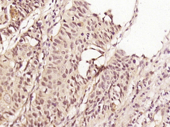 CENPE Rabbit Polyclonal Antibody