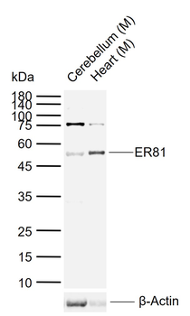ER81 Rabbit Polyclonal Antibody