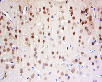 FAM13C1 Rabbit Polyclonal Antibody