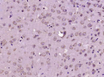 FBXL20 Rabbit Polyclonal Antibody