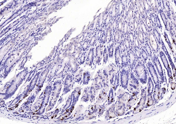 GPR55 Rabbit Polyclonal Antibody