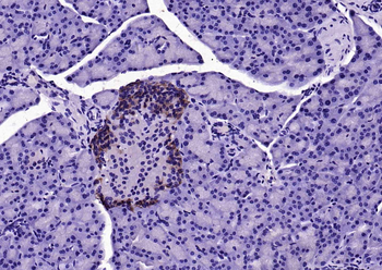 GPR55 Rabbit Polyclonal Antibody