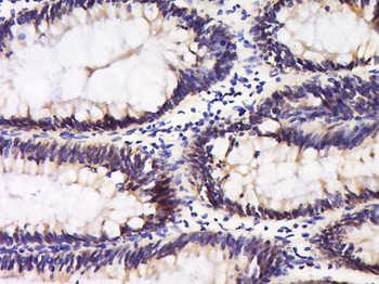 Integrin alpha 5 Rabbit Polyclonal Antibody