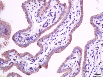 Integrin alpha 5 Rabbit Polyclonal Antibody