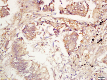 IL17E Rabbit Polyclonal Antibody