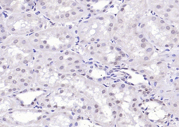 KLF2 Rabbit Polyclonal Antibody