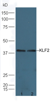 KLF2 Rabbit Polyclonal Antibody